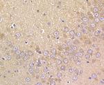 Prolactin Antibody in Immunohistochemistry (Paraffin) (IHC (P))