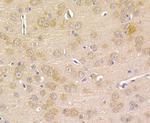 Prolactin Antibody in Immunohistochemistry (Paraffin) (IHC (P))