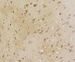 Aminoacylase Antibody in Immunohistochemistry (Paraffin) (IHC (P))