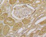 Aminoacylase Antibody in Immunohistochemistry (Paraffin) (IHC (P))