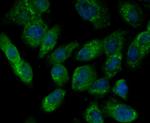 ILK Antibody in Immunocytochemistry (ICC/IF)