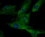 ILK Antibody in Immunocytochemistry (ICC/IF)