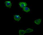 ILK Antibody in Immunocytochemistry (ICC/IF)