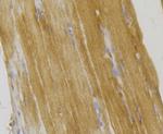 ILK Antibody in Immunohistochemistry (Paraffin) (IHC (P))