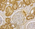 ILK Antibody in Immunohistochemistry (Paraffin) (IHC (P))