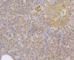 ILK Antibody in Immunohistochemistry (Paraffin) (IHC (P))