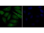 Galectin 3 Antibody in Immunocytochemistry (ICC/IF)