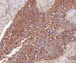 delta Catenin Antibody in Immunohistochemistry (Paraffin) (IHC (P))