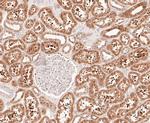 delta Catenin Antibody in Immunohistochemistry (Paraffin) (IHC (P))