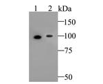 delta Catenin Antibody in Western Blot (WB)