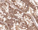 FOXP1 Antibody in Immunohistochemistry (Paraffin) (IHC (P))