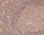 FOXP1 Antibody in Immunohistochemistry (Paraffin) (IHC (P))