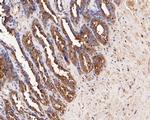 DOG-1 Antibody in Immunohistochemistry (Paraffin) (IHC (P))