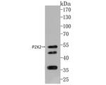 P2X2 Antibody in Western Blot (WB)