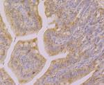 Galectin 4 Antibody in Immunohistochemistry (Paraffin) (IHC (P))