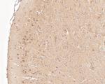 PYCR1 Antibody in Immunohistochemistry (Paraffin) (IHC (P))