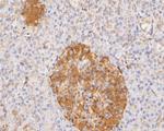 PYCR1 Antibody in Immunohistochemistry (Paraffin) (IHC (P))