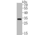 PYCR1 Antibody in Western Blot (WB)