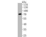 CHRNB2 Antibody in Western Blot (WB)