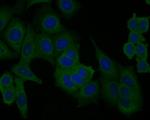 PICK1 Antibody in Immunocytochemistry (ICC/IF)