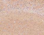 TTL Antibody in Immunohistochemistry (Paraffin) (IHC (P))