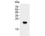 CD35 Antibody in Western Blot (WB)