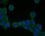 ADAM22 Antibody in Immunocytochemistry (ICC/IF)