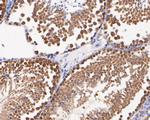 DTNBP1 Antibody in Immunohistochemistry (Paraffin) (IHC (P))