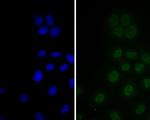 p16INK4a Antibody in Immunocytochemistry (ICC/IF)