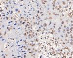p16INK4a Antibody in Immunohistochemistry (Paraffin) (IHC (P))
