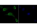 CLIC1 Antibody in Immunocytochemistry (ICC/IF)