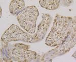 CLIC1 Antibody in Immunohistochemistry (Paraffin) (IHC (P))