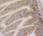 CLIC1 Antibody in Immunohistochemistry (Paraffin) (IHC (P))