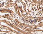 SYNDIG1 Antibody in Immunohistochemistry (Paraffin) (IHC (P))