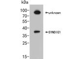 SYNDIG1 Antibody in Western Blot (WB)