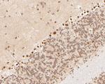 Cullin 4B Antibody in Immunohistochemistry (Paraffin) (IHC (P))