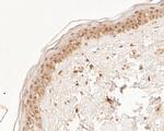 NAT13 Antibody in Immunohistochemistry (Paraffin) (IHC (P))