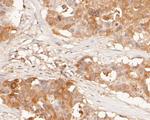 NAT13 Antibody in Immunohistochemistry (Paraffin) (IHC (P))