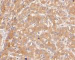 SERPINA6 Antibody in Immunohistochemistry (Paraffin) (IHC (P))