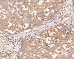 SERPINA6 Antibody in Immunohistochemistry (Paraffin) (IHC (P))