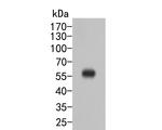 SERPINA6 Antibody in Western Blot (WB)