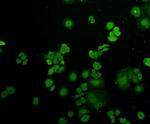 Ubiquitin Antibody in Immunocytochemistry (ICC/IF)