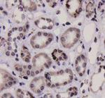 STAT1 alpha/beta Antibody in Immunohistochemistry (Paraffin) (IHC (P))