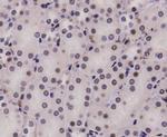 STAT1 alpha/beta Antibody in Immunohistochemistry (Paraffin) (IHC (P))