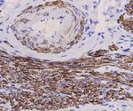 Desmin Antibody in Immunohistochemistry (Paraffin) (IHC (P))