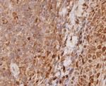 STAT6 Antibody in Immunohistochemistry (Paraffin) (IHC (P))