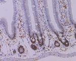 STAT6 Antibody in Immunohistochemistry (Paraffin) (IHC (P))