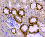 Catalase Antibody in Immunohistochemistry (Paraffin) (IHC (P))