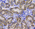 Catalase Antibody in Immunohistochemistry (Paraffin) (IHC (P))