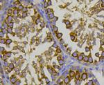 HSP70 Antibody in Immunohistochemistry (Paraffin) (IHC (P))